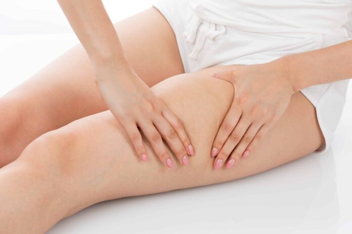 Puchnięcie nóg od kolan w dół