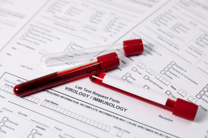 Jakie badania profilaktyczne warto wykonywać regularnie?